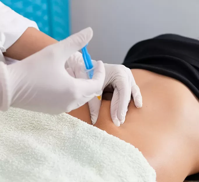 Mesotherapy Newcastle Upon Tyne