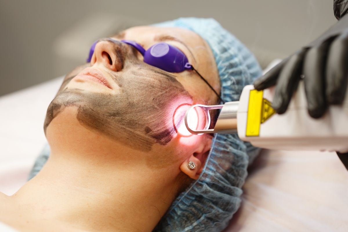 A Complete Guide To Laser And IPL Treatments